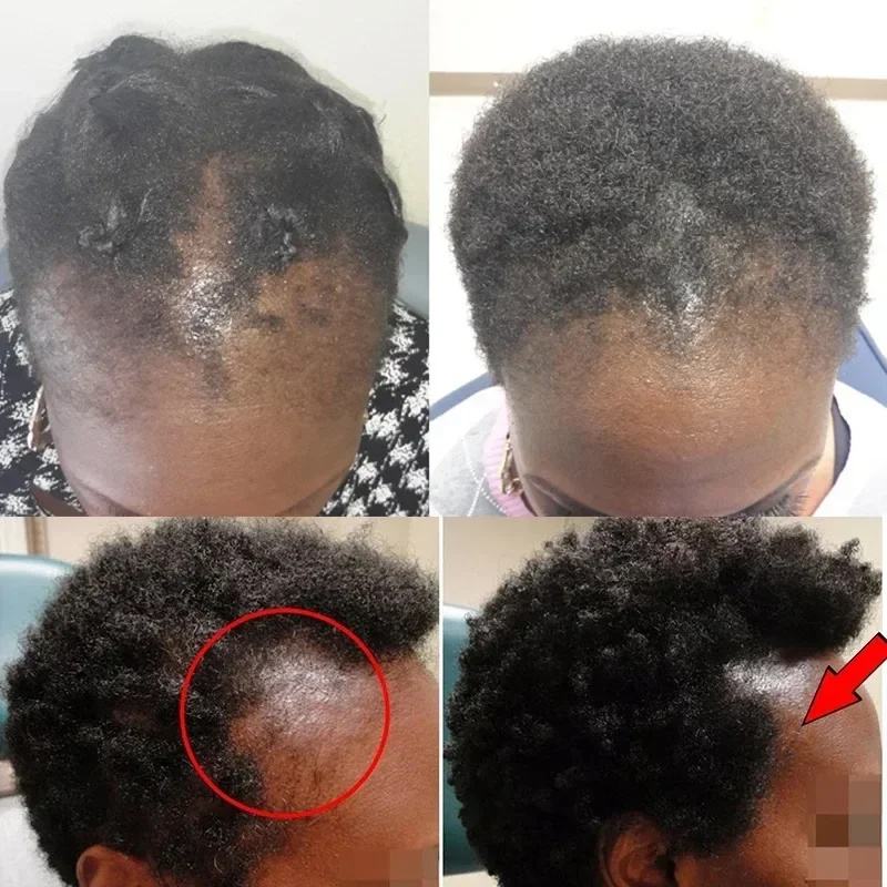 Batana óleo de crescimento cap - Bond Repair Shampoo avaliação e preço