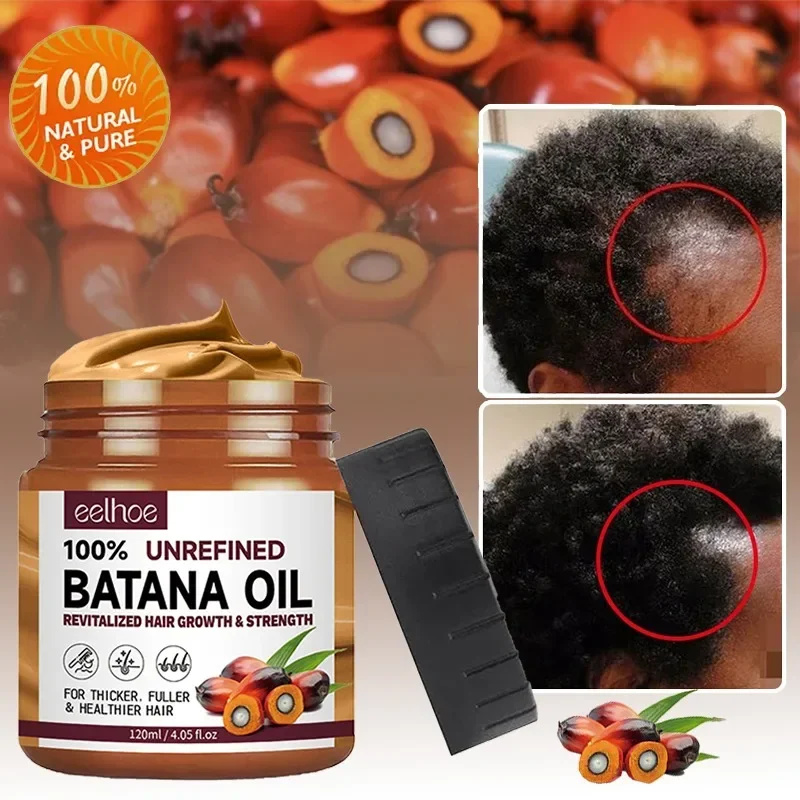 Batana óleo de crescimento cap - Bond Repair Shampoo avaliação e preço