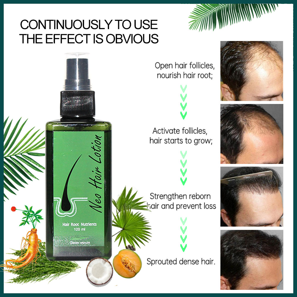 4 unidades de Loção Capilar Ne - Hair Care Nutrition avaliação e preço